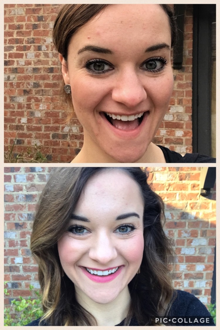 Nerium Before and After