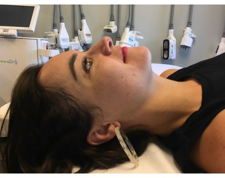 A Complete Microneedling Experience FAQ: Everything You Should Know by Life + Style Blogger, Heather Brown // My Life Well Loved